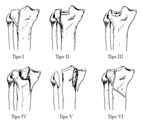 fig.2