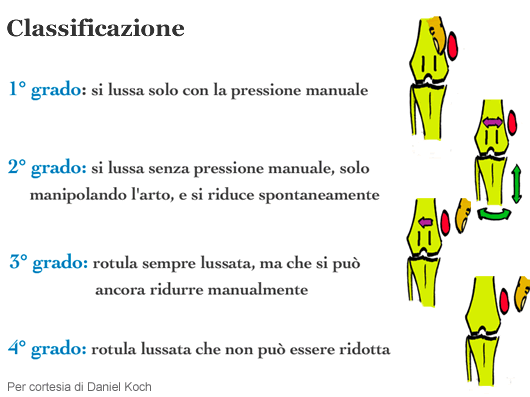 lussazione01