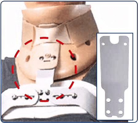 Placchetta 962 per connessione Iperestensori Camp con collare Philadelphia 961