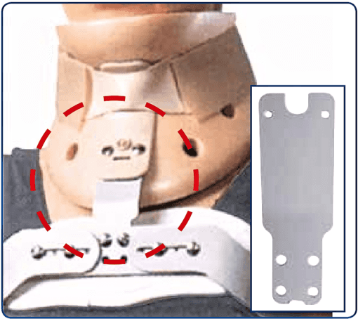 Placchetta 962 per connessione Iperestensori Camp con collare Philadelphia 961