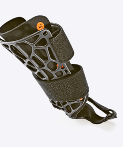 7059 MCO Distorsioni del polso e del carpo Instabilit&agrave; legamentose, tendinopatie Post-intervento