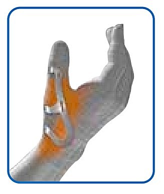SP 208 SCHELETRO Ortesi Pollice Airprene Supporto Rigido Modellabile Struttura in neoprene a cellule aperte Supporto in alluminio conformabile Chiusura con tiranti a Velcro®