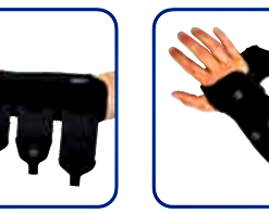 Tutore Lungo Polso Mano con chiusura &ldquo;BOA&rdquo; per Trattamento conservativo o post-operatorio delle lesioni del complesso fibrocartilagineo triangolare (TFCC)