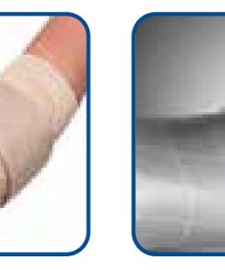 Gomitiera in elastico con pressori bilaterali in silicone inclusiva di una fascia pressoria per stabilizzare i tendini gomito